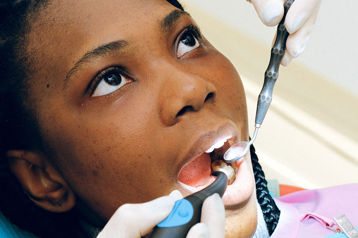 Dental-Fillings in Uganda